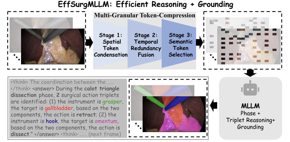 Surgical scene understanding